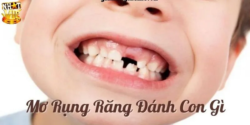 Mơ Thấy Răng Rụng - Giải Mã Điềm Báo Và Con Số May Mắn