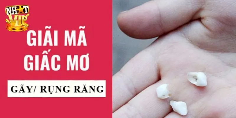 Mơ Thấy Răng Rụng Điềm Gì? Thông Tin Hữu Ích Cho Các Bạn